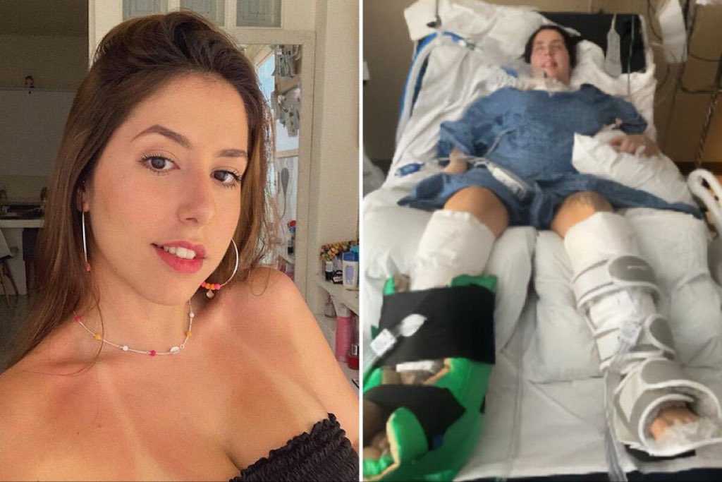 VichVideo's tweet photo. In April 2024, Claudia de Albuquerque Celada was paralyzed after consuming canned soup contaminated with the bacteria C botulinum. These toxins attack the nervous system and can result in paralysis.

23-year-old Celada, originally from Brazil, was on a work exchange program in Aspen when she started suffering dizziness, double vision, and trouble breathing.

Though fewer than five of every 100 people with botulism die, according to the CDC, it can cause lifelong disability and extreme physical therapy.
