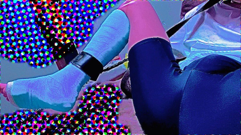 JfG4l's tweet photo. このとき電マ当ててもらって
スパッツごしに写生した
#骨折　#ギプス　#legcast #castfetish https://t.co/Wkg9Ajd3aW