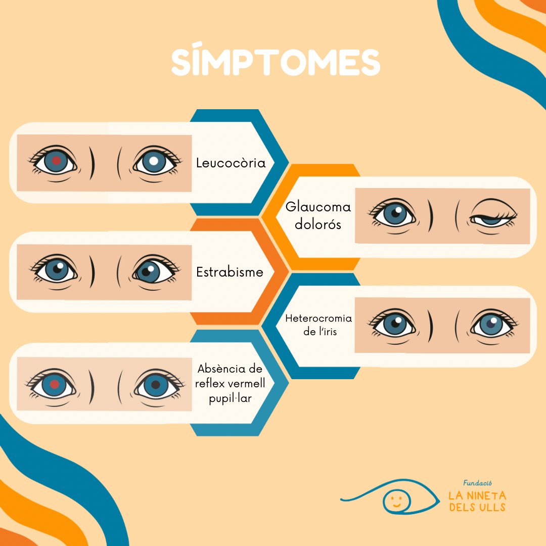 laninetadelsull's tweet photo. 👁️Seguimos con la #RBWeek recordando los principales síntomas.

🩺La detección precoz es básica para el buen transcurso de la enfermedad.

📲Estamos desarrollando una app para detectar el retinoblastoma y otras enfermedades oculares con una simple fotografía hecha con el teléfono https://t.co/g6ii2SZl0D