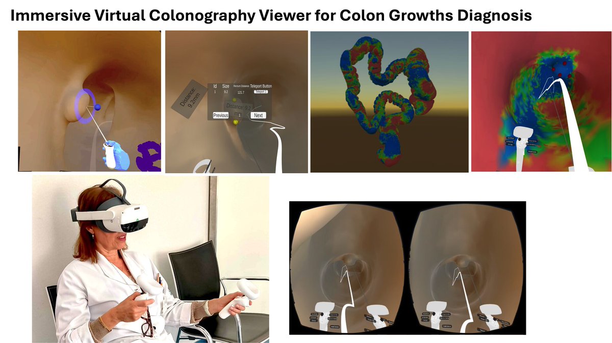 Happy that our paper, 'Immersive Virtual Colonography Viewer for Colon Growths Diagnosis: Design and Think-Aloud Study', is published in the  Multimodal Technologies and Interaction Journal. Read the #OA paper: mdpi.com/2414-4088/8/5/… #VR #OpenAccess #VirtualReality #eyetracking
