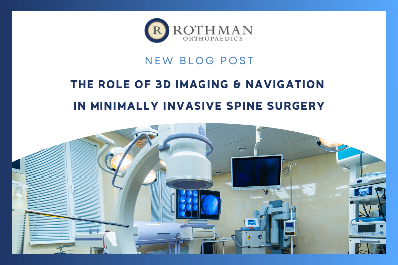 Spinal Navigation Systems are comprised of two technologies that seamlessly integrate to allow surgeons to “see through” the intact skin and muscle to the spinal anatomy below. Read more: bit.ly/3wudmxT