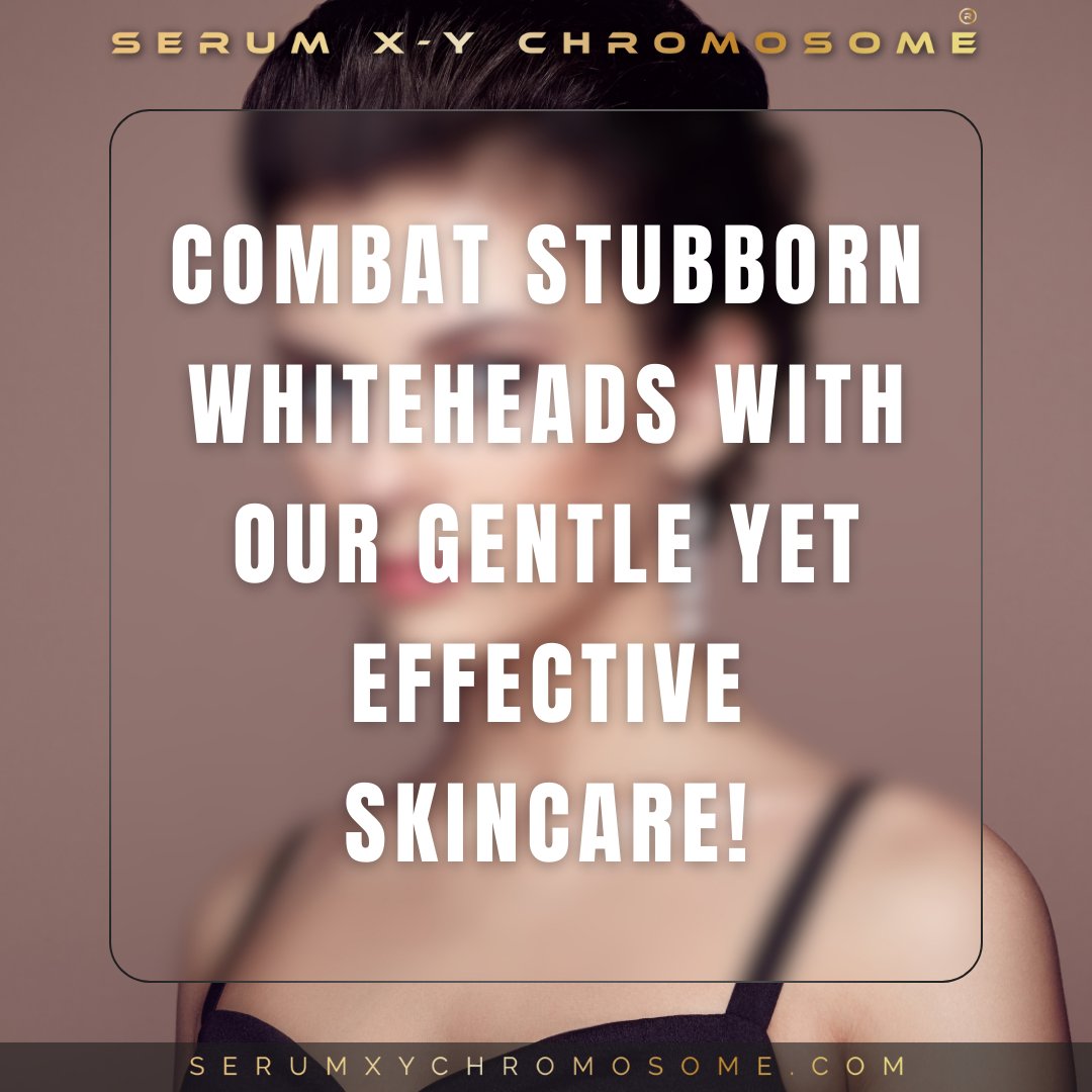 Combat stubborn whiteheads with our gentle yet effective skincare! ⚪️ Whiteheads, caused by clogged pores filled with oil and dead skin cells, can be challenging to address. #WhiteheadRemoval #ClearSkin #GentleExfoliation #BreakoutControl #SkinCareTips #SERUMXYCHROMOSOME