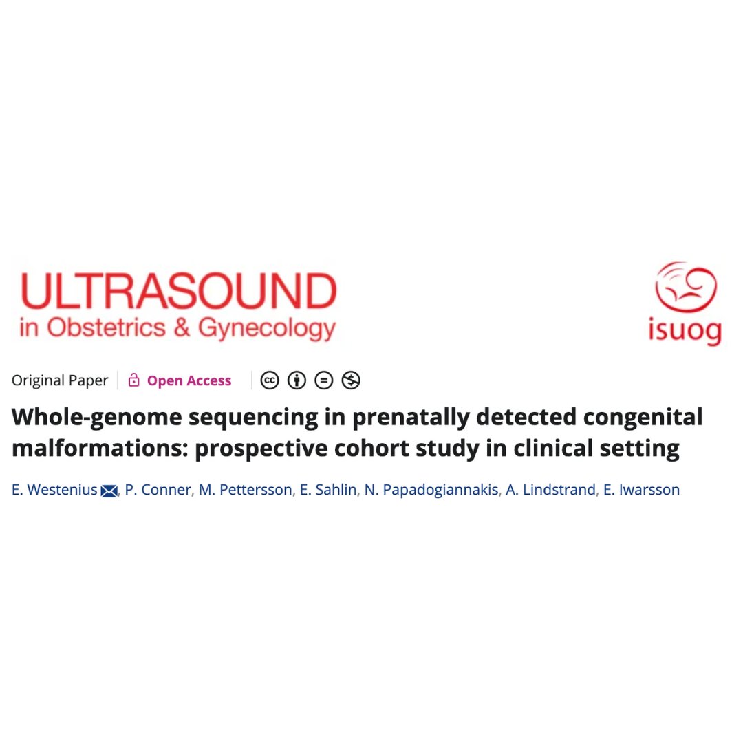 Westenius et al. demonstrate a diagnostic yield of 26% with clinical whole-genome sequencing trio analysis in cases of prenatally detected fetal abnormalities after excluding chromosomal aberrations in a new open-access #UOGJournal study. Read now: bit.ly/3UNhNx4