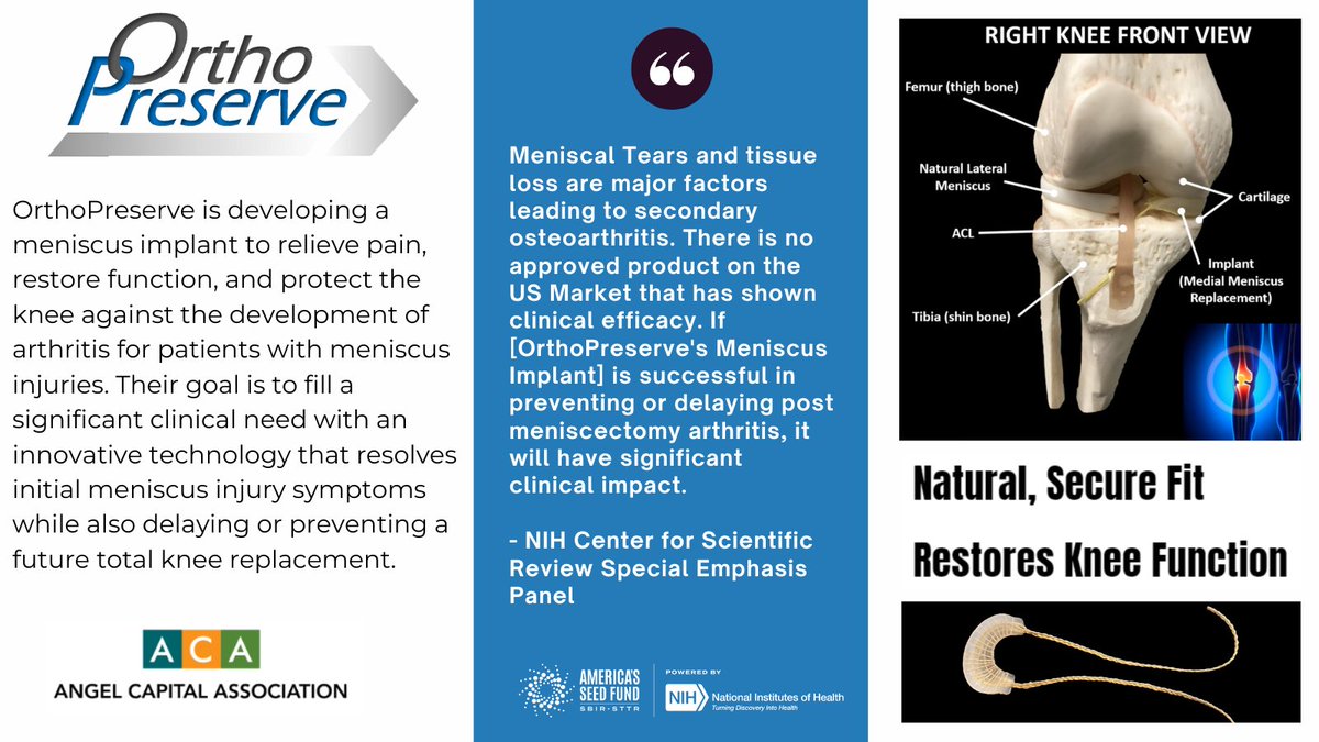 OrthoPreserve is developing a meniscus implant to relieve pain, restore function, and protect the knee against the development of arthritis for patients with meniscus injuries. orthopreserve.com

#AngelInvesting #AngelInvestments #AngelInvestors #ACASummit2024 #SBIR #STTR