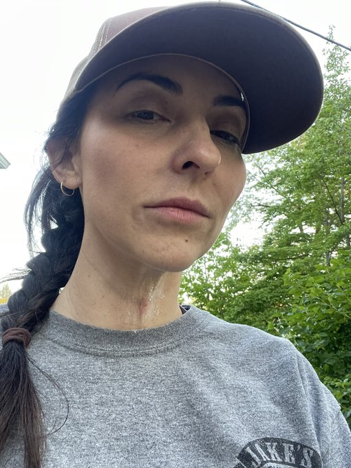 First bee sting of the year! Right on my throat 😂 would not recommend. https://t.co/MnupIHDYIw<a href="/tag/realloyalfans"class="tags"><span>#realloyalfans</span></a>