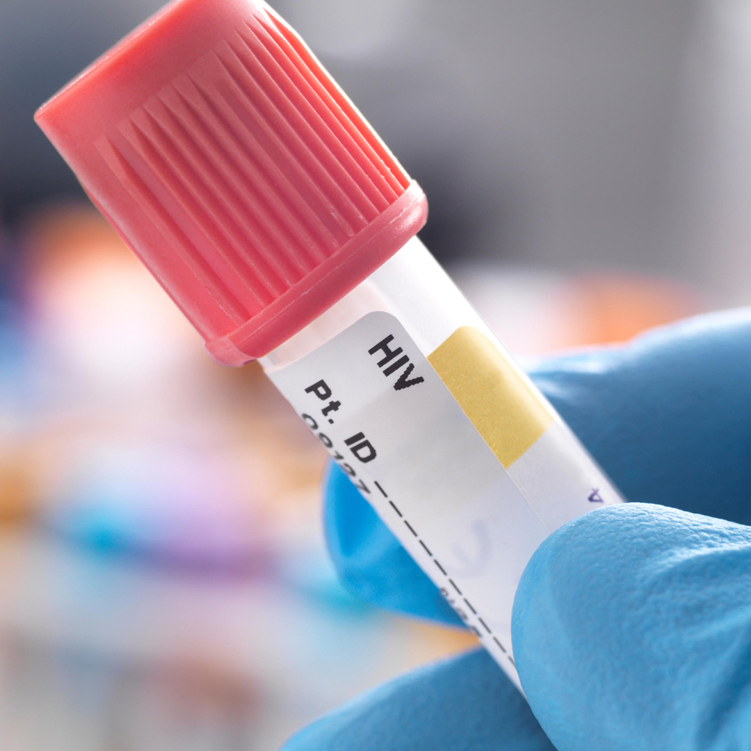 HIV testing has evolved and improved since the first tests were introduced in the 1980s. Explore how the extraordinary improvements in high-sensitivity HIV testing are helping patients know their status earlier. Read blog: bit.ly/4bk5sWt