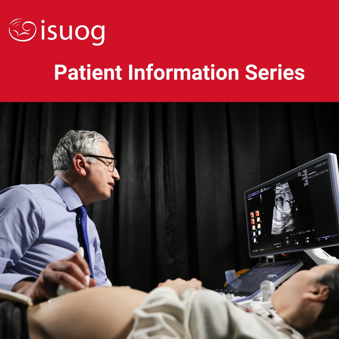 Discover #ISUOG's online Patient Information leaflets. Available in Spanish, English & Chinese, they cover a range of #obgyn topics to empower your patients to make informed decisions. Access the resources for free bit.ly/3oDnn47