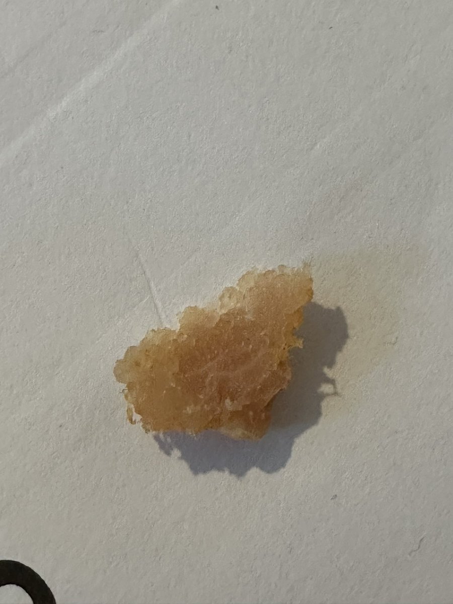 JUSTaims's tweet photo. Can only describe what I’ve just found in my Cod &amp; chorizo fishcake from @Tesco as human flesh. Want to be sick it’s all rubbery 🤢🤢🤢 https://t.co/OwSXUQMPNm