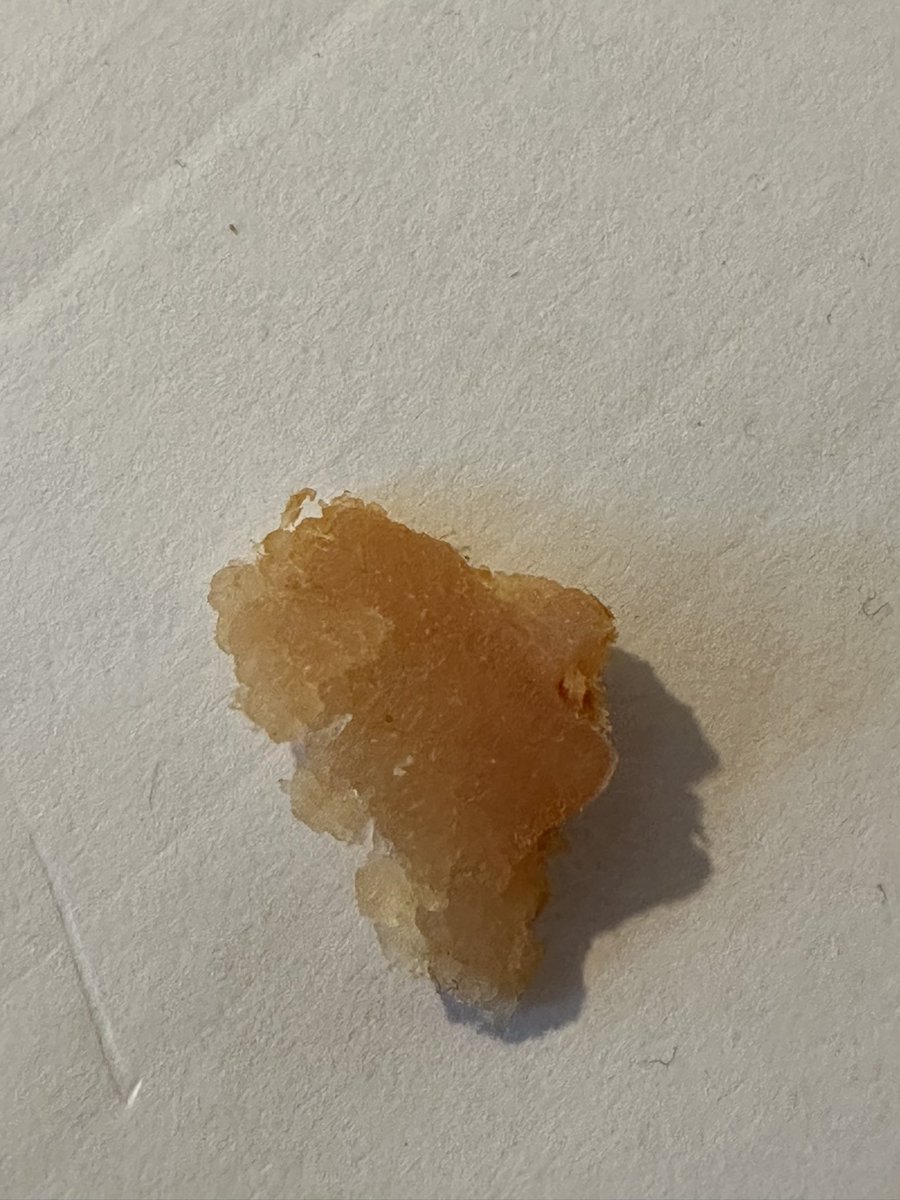 Can only describe what I’ve just found in my Cod &amp; chorizo fishcake from <a href="/Tesco/">Tesco</a> as human flesh. Want to be sick it’s all rubbery 🤢🤢🤢