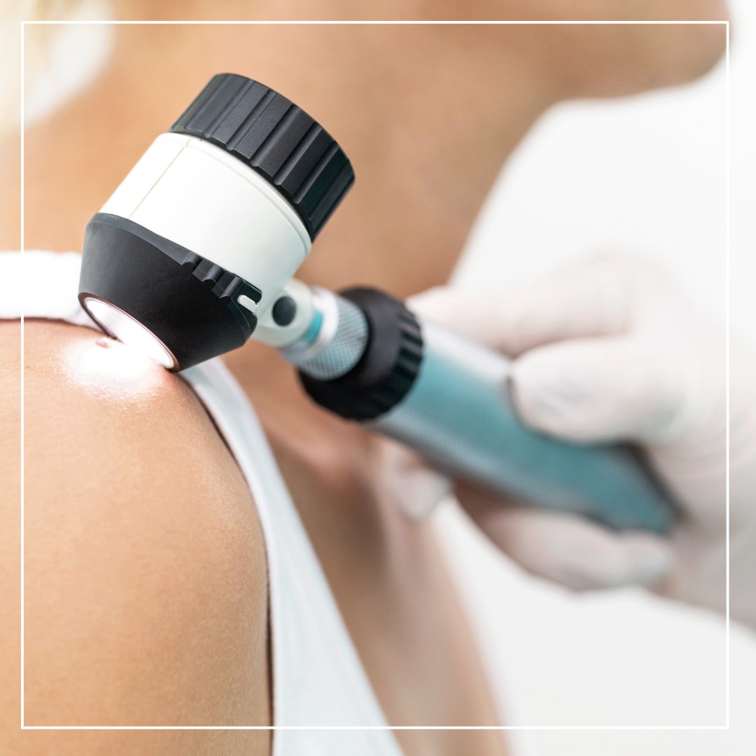 This Skin Cancer Awareness Month, we remind you to schedule your annual skin check. Early detection saves lives. Book your appointment today!

#SkinCancerAwareness #GetChecked #Dermatology #SkinHealth #RevelusCare