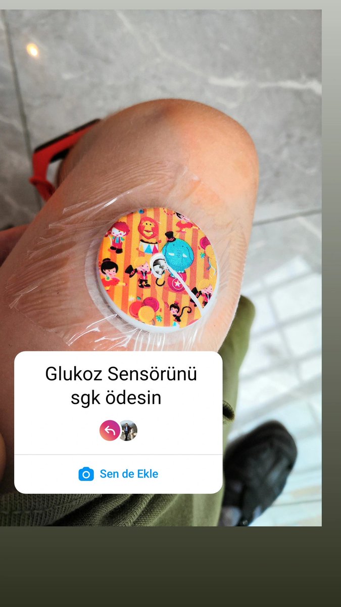 20akalan's tweet photo. Bunca teknolojik imkan içinde SGK sensör ve pompaları karşılamadığı için tip 1 diyabetliler büyük zorluklar yaşıyorlar. Sağlıklı ve aydınlık yarınlar için sensör ve pompa herkes için karşılansın #parmağımdelinmesin @anadoludiyabet @isikhanvedat @herkesicinCHP @Akparti @MHP_Bilgi https://t.co/S5OLkxJhjt