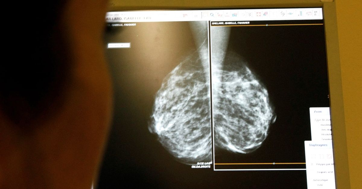 New breast cancer genes found in women of African ancestry, may improve risk assessment reut.rs/3JXOL7N