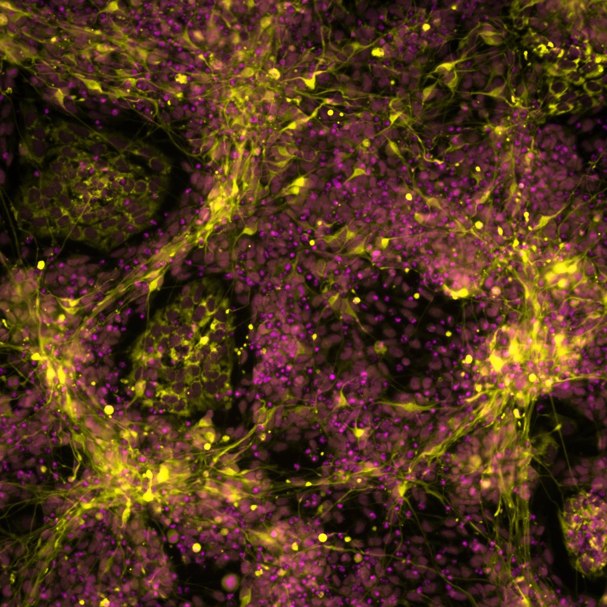 Partly funded by Neuroblastoma UK, researchers at @sheffielduni & @StAnna_CCRI have created a model to investigate the origins of neuroblastoma, offering hope for the creation of tailored treatments, minimising current adverse effects for patients. Visit: bit.ly/3WDKmya