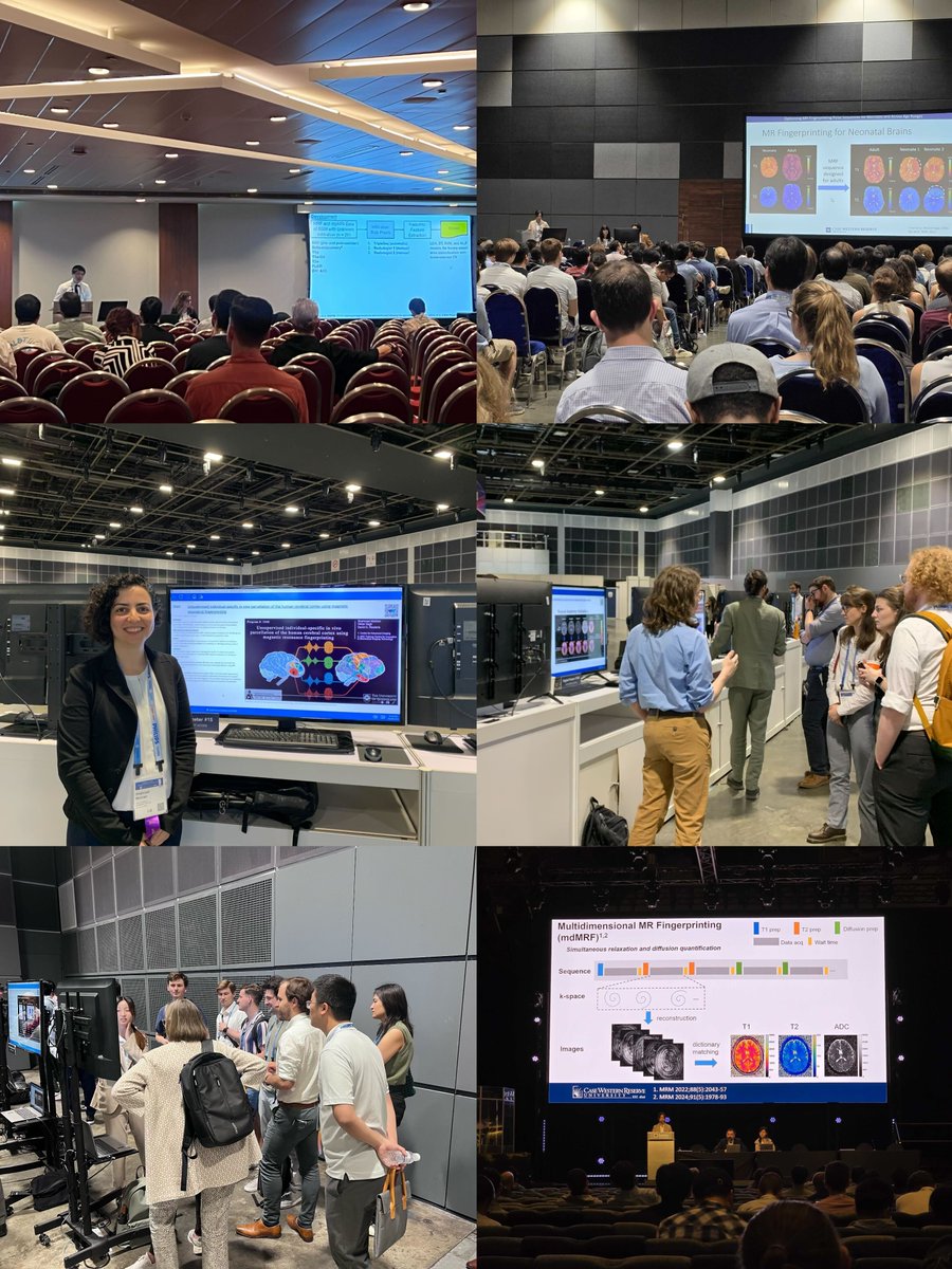 Dan Ma (@mri_dan) on Twitter photo #ISMRM2024. 2 orals, 2 power pitches and 2 posters. Shout out to the amazing efforts from our trainees. <a href="/mri_siyuan/">Siyuan Hu</a> <a href="/MRI_Wally/">Walter Zhao</a> <a href="/MRI_Zhilang/">Zhilang Qiu</a> @MRI_James <a href="/ShMoinian/">Shahrzad</a> #ISMRM2024. 2 orals, 2 power pitches and 2 posters. Shout out to the amazing efforts from our trainees. <a href="/mri_siyuan/">Siyuan Hu</a> <a href="/MRI_Wally/">Walter Zhao</a> <a href="/MRI_Zhilang/">Zhilang Qiu</a> @MRI_James <a href="/ShMoinian/">Shahrzad</a>