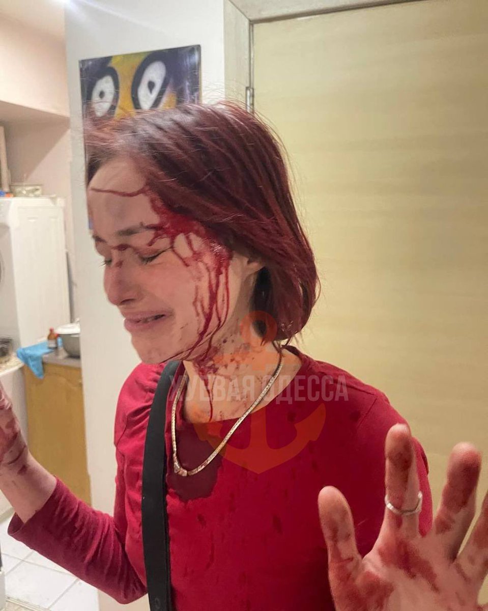 🇺🇦 Ukrainian military beat her up with sticks for filming her boyfriend’s conscription.