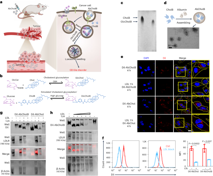 New content online: Nanoparticles for inducing Gaucher disease-like damage in cancer cells dlvr.it/T6qlnq