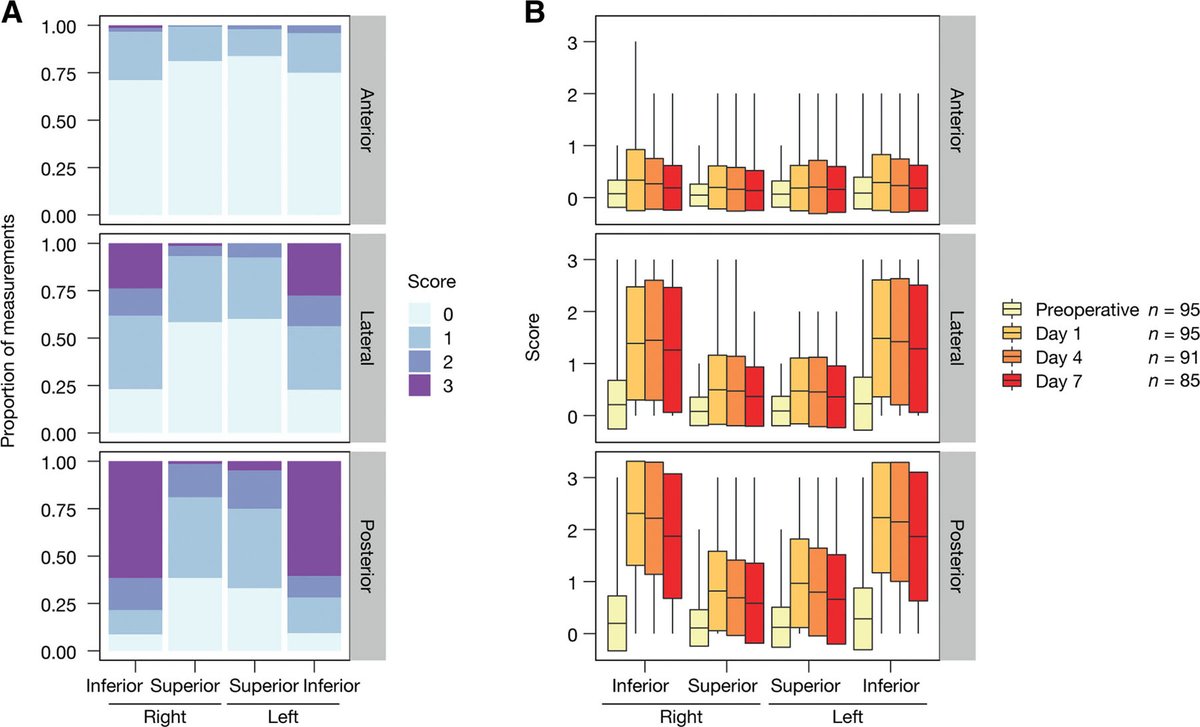 An elevated lung ultrasound score on postoperative day 1 is associated with the occurrence of pulmonary complications within the first 10 days after major abdominal surgery. Read the research: ow.ly/rmFP50RzFM2