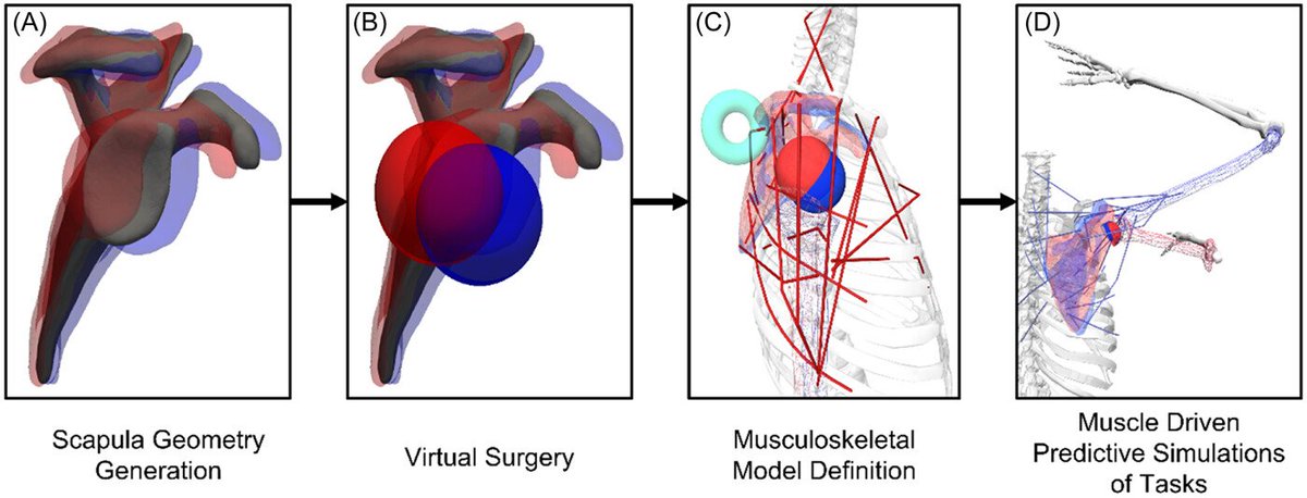 Discoveries in @JOrthopRes uncover how scapular morphology influences biomechanics after reverse total #shoulder #arthroplasty (#RTSA). This study highlights the importance of considering individual anatomy for optimal outcomes. @ORSsociety #ORSSMC doi.org/10.1002/jor.25…