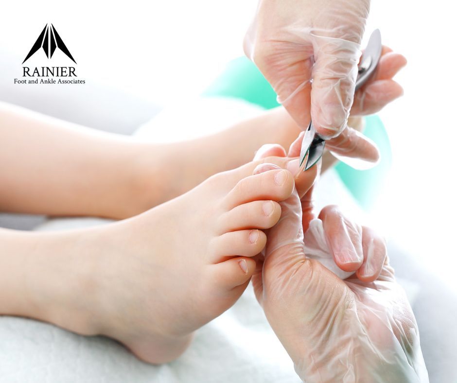 rainierfootankl's tweet image. Ingrown toenails can be painful for children. We provide gentle treatments and teach you preventive measures to keep your child's toes happy! #IngrownToenail #ChildFootCare #RFAA