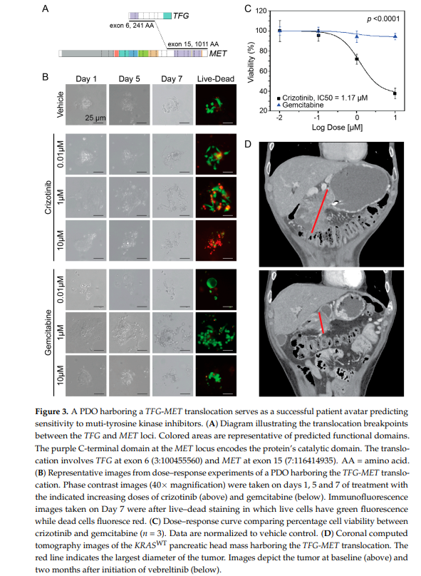 ADesaiMD's tweet image. 🚀In our latest 📜we explored the molecular characteristics of #KRAS wt #PDAC and found actionable genetic variants. 
➡️TFG-MET rearrangement showed response to a c-MET inhibitor. 
Precision medicine #futureisnow! 🔬 @RMCarrLab @AMansfieldMD @GIcancerDoc bit.ly/4bgHBHM