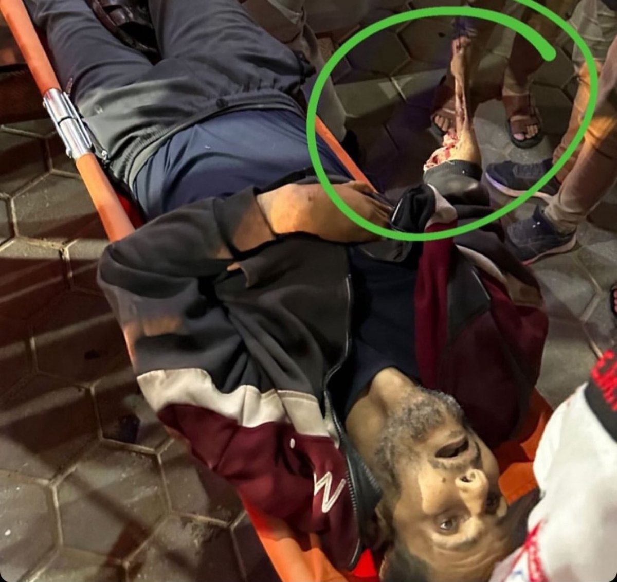 This Palestinian man was killed by a Zionist airstrike, the aidworkers couldn’t get to him because of the danger so stray dogs savagely ate and ripped his arm to the bone 

Gaza