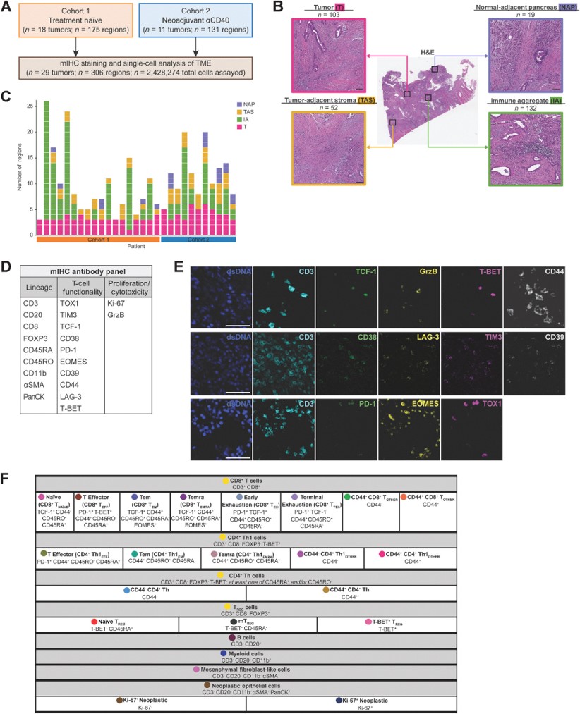 From the May issue— Machine Learning Links T-cell Function and Spatial Localization to Neoadjuvant #Immunotherapy and Clinical Outcome in #PancreaticCancer, by Katie E. Blise et al. bit.ly/3UVQzEq @OHSUNews