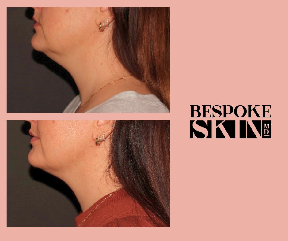 Bespoke Skin MD tweet media