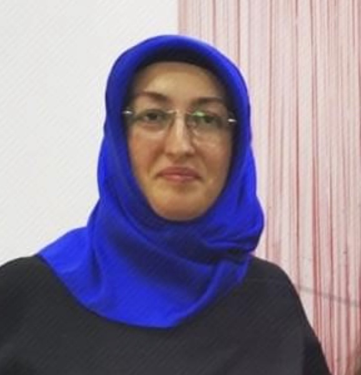 1 yıl içindeki estetik mucizesi yeni imaj çok başarılı. Bu operasyonlara maruz kalan yüzün ödem atması 5-6 ay alır . Sinan Ateş in hemen ardından işlemler başlatılmış demek ki !! Tam bir görev talimat kadını hemen yeni rolünün hazırlıklarına başlamış 
#SinanAteşİçinAdalet