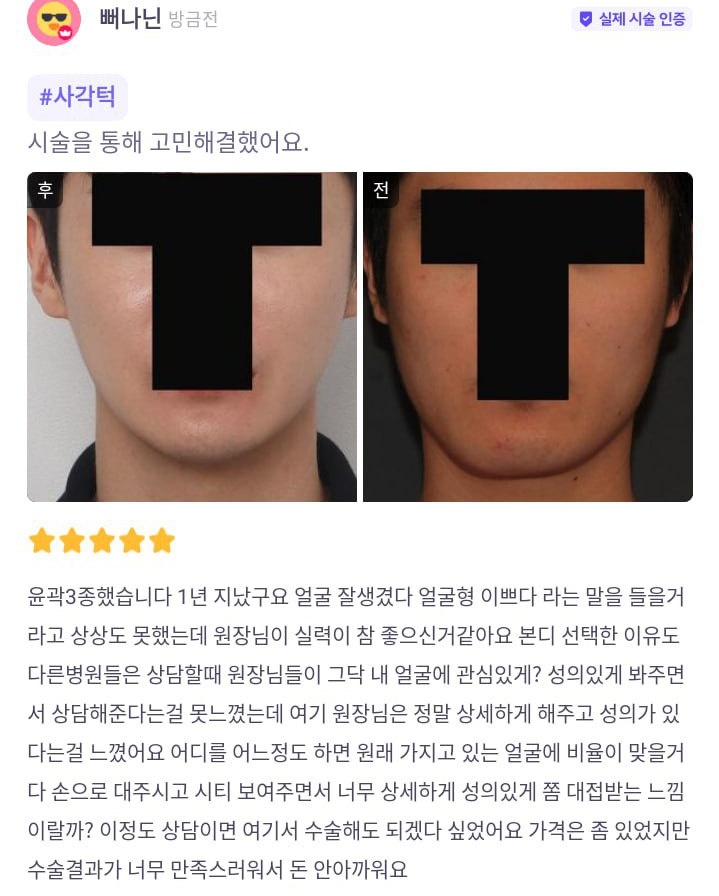 他の病院とは違って、ボンディ院長は私の顔に関心を持って相談を詳細にしてくれました。値段が少し負担でしたが手術の結果がとても満足してお金が全然もったいないです。

#バービートーク #カンナムオンニ #輪郭整形
#Vライン #卵型 #整形垢 #垢抜け