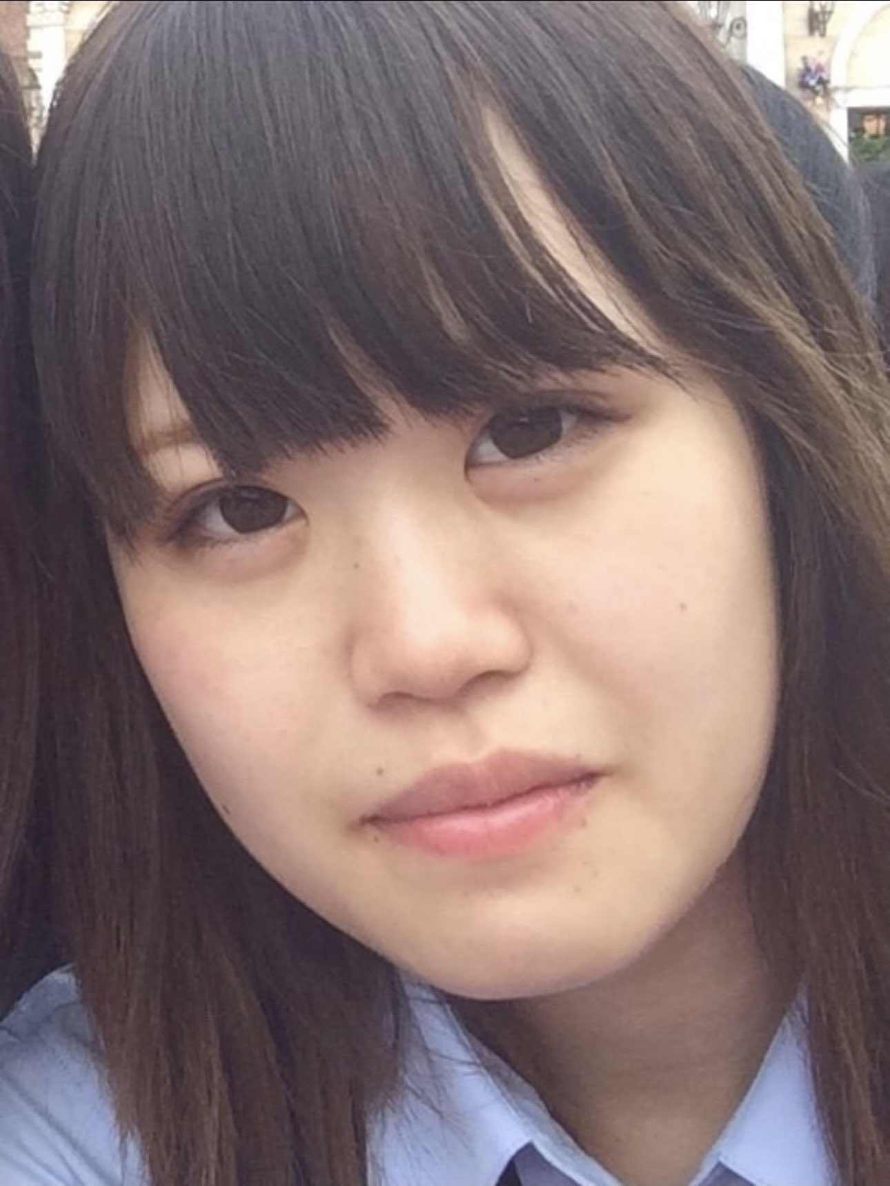 轟 ちゃん 整形 前