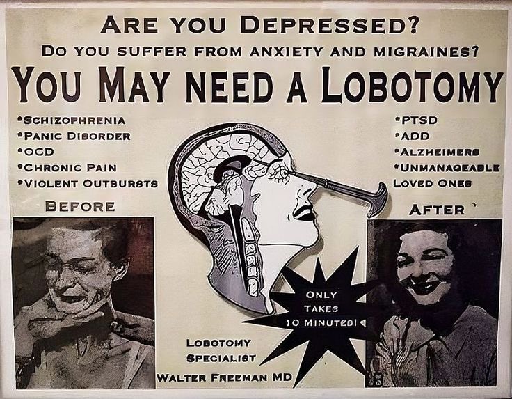 lobotomy time!!!!