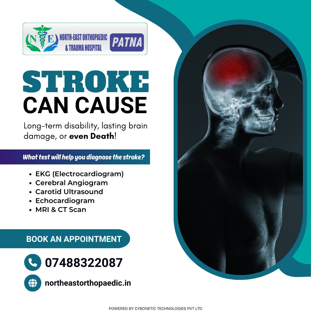 Did you know? Stroke can lead to long-term disability, lasting brain damage, or even death! Stay informed, stay healthy. 💡

Book an Appointment:
☎+91-74883-22087
🌐northeastorthopaedic.in

#StrokeAwareness #KnowTheRisk #PreventStroke #BrainHealth #Stroke #BrainDamage #Patna