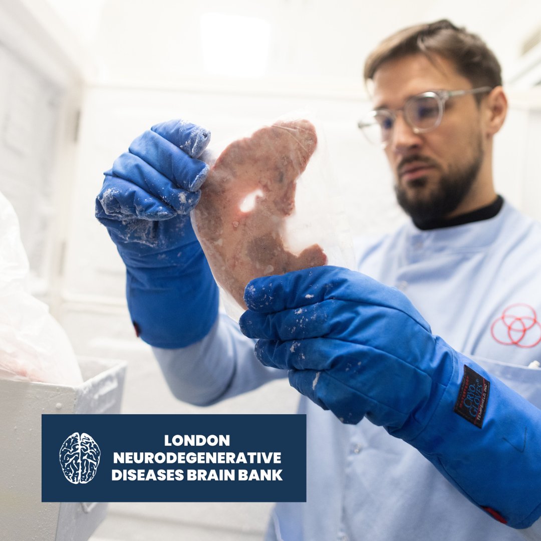 In #neuroscience, access to #human #tissue for research is vital. Our brain bank has frozen tissue samples from a wide variety of pathological diagnoses that researchers can access.