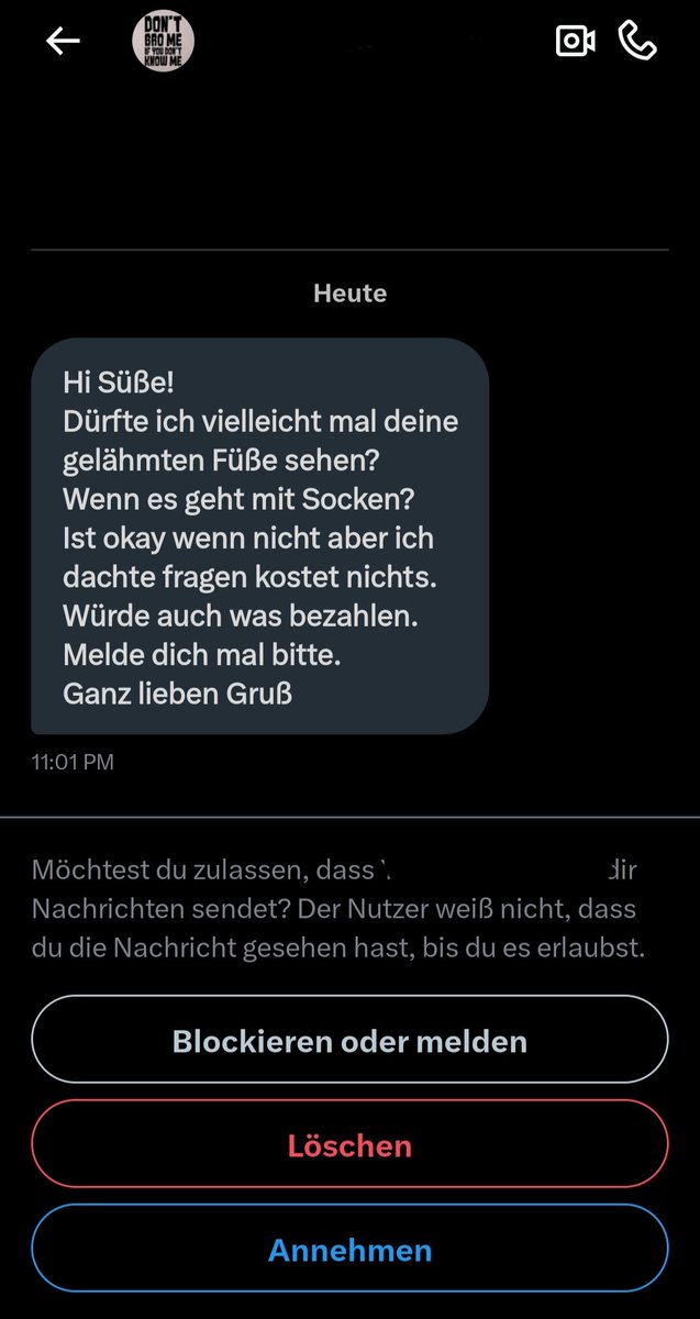 Sach ma, 
Einigen brennt doch hier echt immer mehr der Hut!
Alter, geh mal Gras anfassen!
Wenn du nen Fetisch hast, melde dich in nem Fetisch-Forum an, aber lass mich hier mit deinem Scheiß zufrieden!
Ey, du merkst es doch nicht mehr!
#Belästigung
#Behinderung
#FckYou
#Rollstuhl