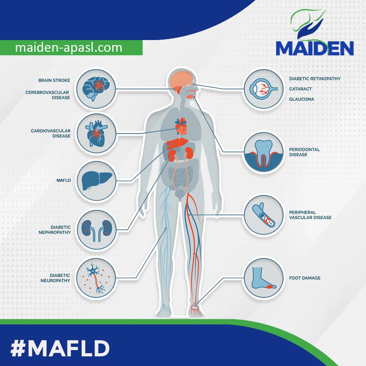 📣📣 #Diabetes care used to just be about the ABCs (HbA1c, blood pressure, cholesterol). 🚨 Now there is a 4thpillar equal to all the others: ✅ Optimizing target-organ protection (Liver, heart and kidney). #livertwitter #medtwitter #MAFLD