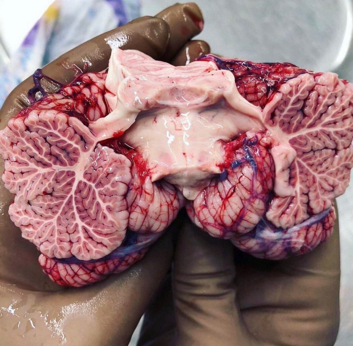 Which anatomical structure is this? Comment ur answer