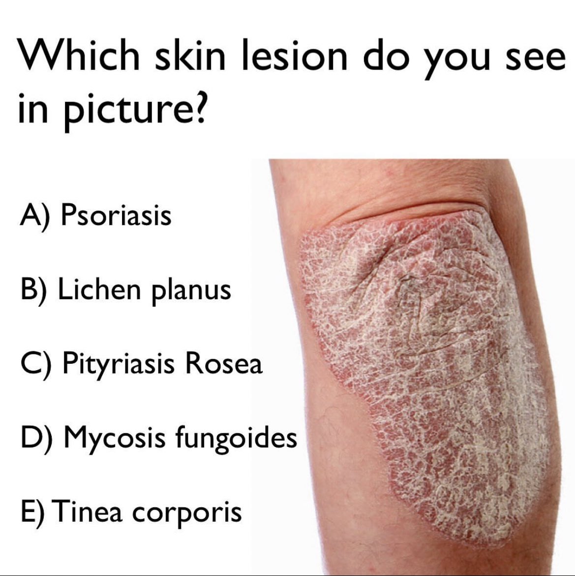 Which skin lesion do you see in picture? Comment your answer