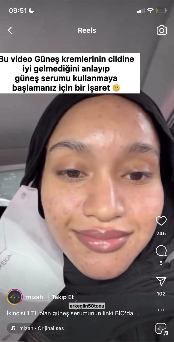 X tweet media