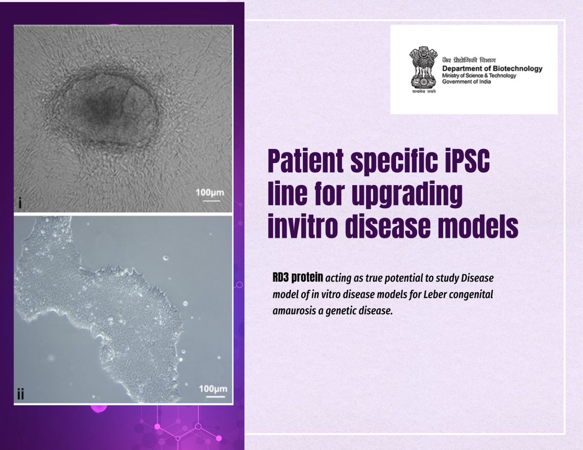 Patient specific iPSC lines carrying a homozygous splice site mutation within the LCA12 candidate gene, RD3 protein opens up potential avenues for development of in vitro disease models for Leber congenital amaurosis.
<a href="/DrJitendraSingh/">Dr Jitendra Singh</a> <a href="/rajesh_gokhale/">Rajesh Gokhale</a> <a href="/lvprasadeye/">LVPEI</a>