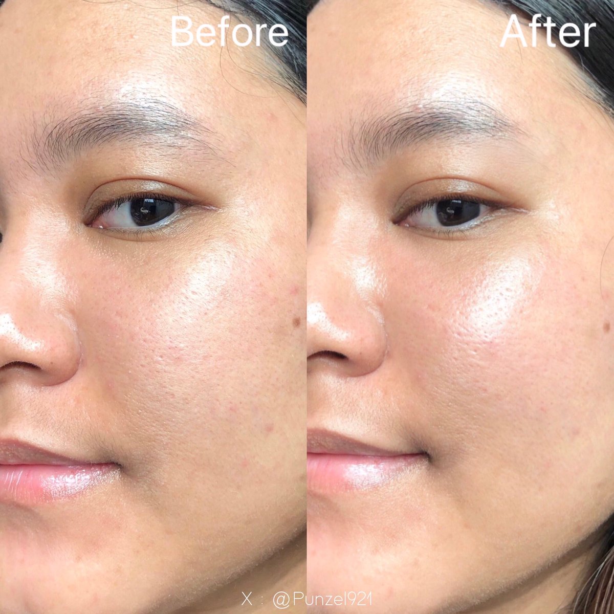 punzel921's tweet photo. นี่ลอง #Dermartlogy ATG Ultrasoothe Rejuvenating Serum ตัวนี้เป็น #สูตรใหม่ ช่วยลดอาการระคายเคืองได้ดีทันที คือเนื้อเซรั่มเขาบางเบา ซึมง่าย ไม่อุดตัน #ผิวอ่อนแอ เเพ้ง่าย และชอบเป็นผื่นบนหน้า ลองใช้ละชอบมากรู้สึกได้เลยว่า #ผิวแข็งแรงขึ้น #ATGSerum #Symsitive #Dermskintech https://t.co/CX7bNizTIZ