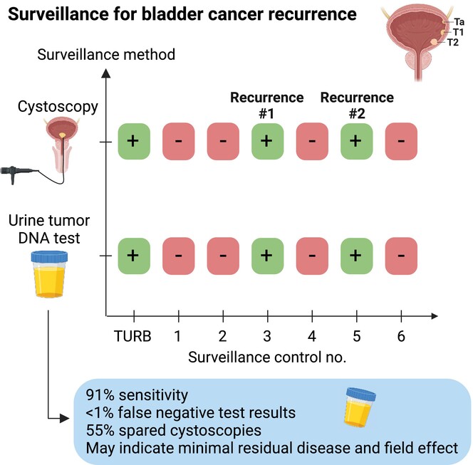 Distinct longitudinal patterns of urine tumor DNA in patients undergoing surveillance for bladder cancer

🔗buff.ly/4bihcsT

#LiquidBiopsy #TumourDNA 
#BladderCancer #BLCSM @GuroLind
