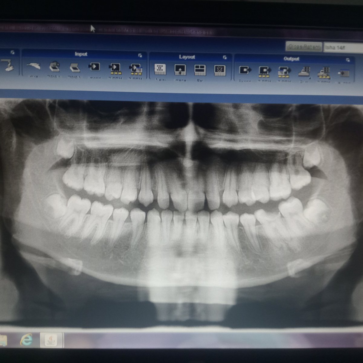 You can just click picture of X-RAY in your MOBILE PHONE  at Dental Department, Government Medical College and Hospital Sector 32 Chandigarh. No film is provided. How long you can save X-ray in mobile.
@MoHFW_INDIA @GMCH_CHD @chandigarh_admn @HinaRohtaki @ManishTewari