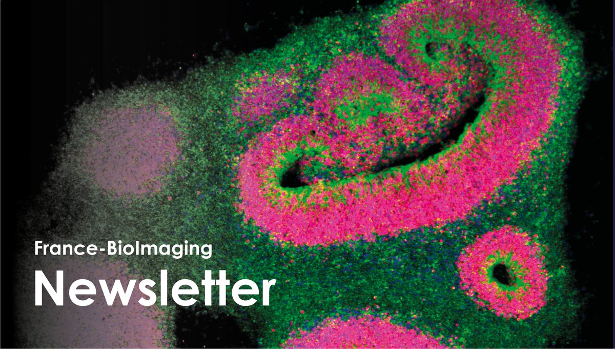 📨The FBI #newsletter of May is out! Find out about our latest news, upcoming events and opportunities for user access funding! 👉france-bioimaging.org/newsletter/fra… 🔬'Mitochondria in neurogenesis'- Chiara Cimmaruta from @LabRicchetti @institutpasteur
