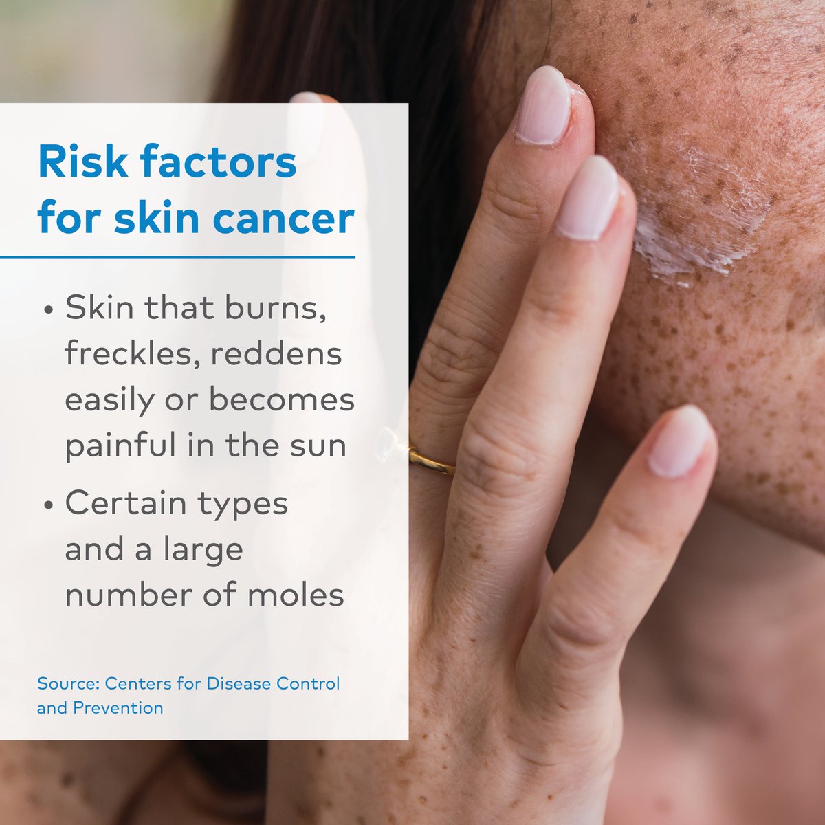Protecting your skin goes beyond applying sunscreen! It's important to understand skin cancer risk factors. Here are some key risk factors to keep in mind. Regular skin checks and sun-safe habits are also essential. #ImproveMoreLives #SkinCancerAwareness