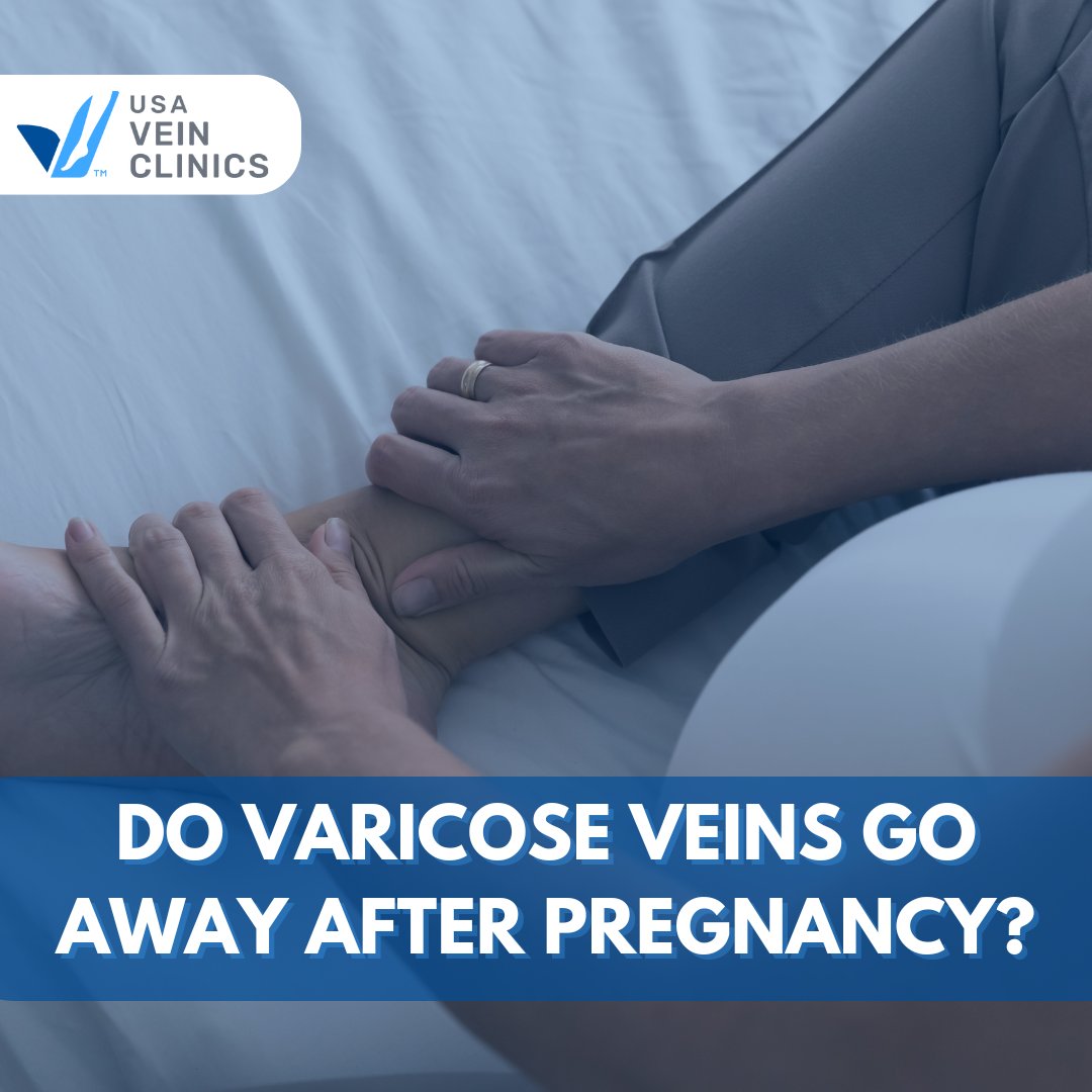 usaveinclinics's tweet photo. If you’re feeling discomfort or experiencing painful symptoms, we encourage you to speak with one of our vein specialists.
👉 Visit our website to schedule an appointment: https://t.co/JFFSvFOTOD Most insurances accepted.
#USAVeinClinics #VaricoseVeins #VeinTreatment #EVLT https://t.co/eoTX9Kjj6k