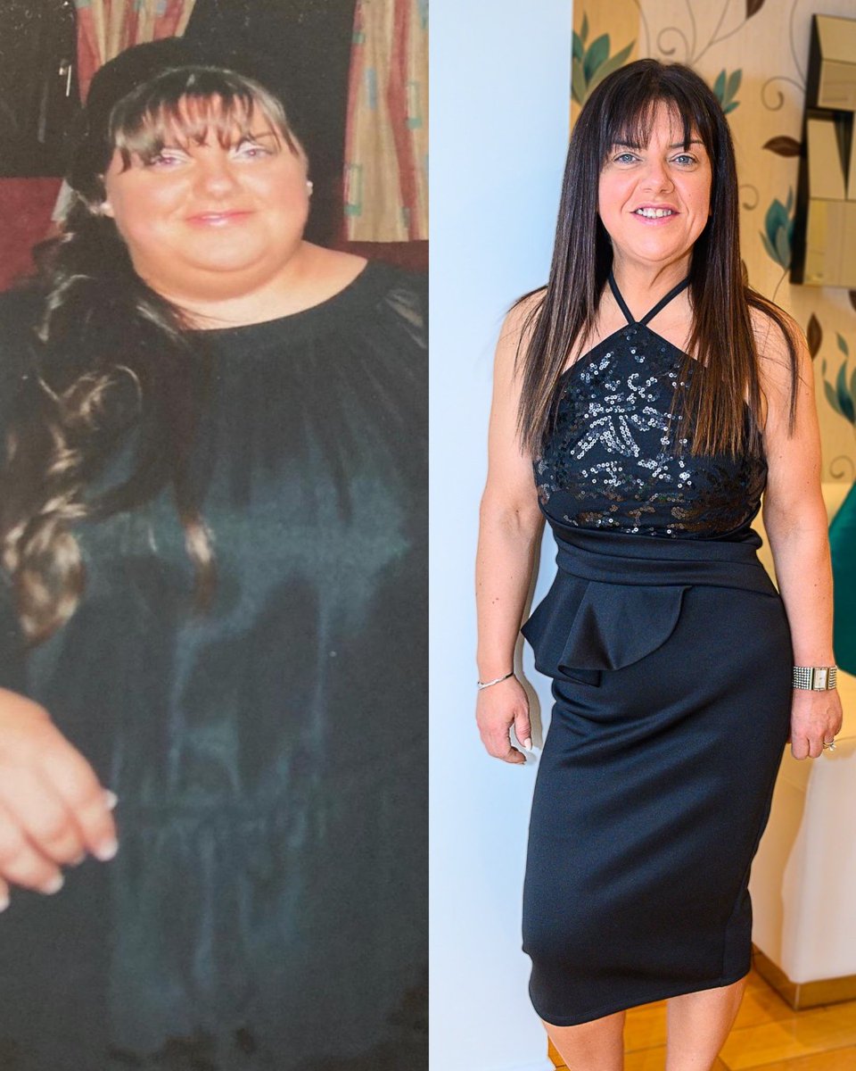 Since joining Slimming World, Jennifer is 9st lighter and has improved her health – so much so that her type 2 diabetes is in remission 🙌. Read more about her inspirational story here: ow.ly/BHOB50RE4sI