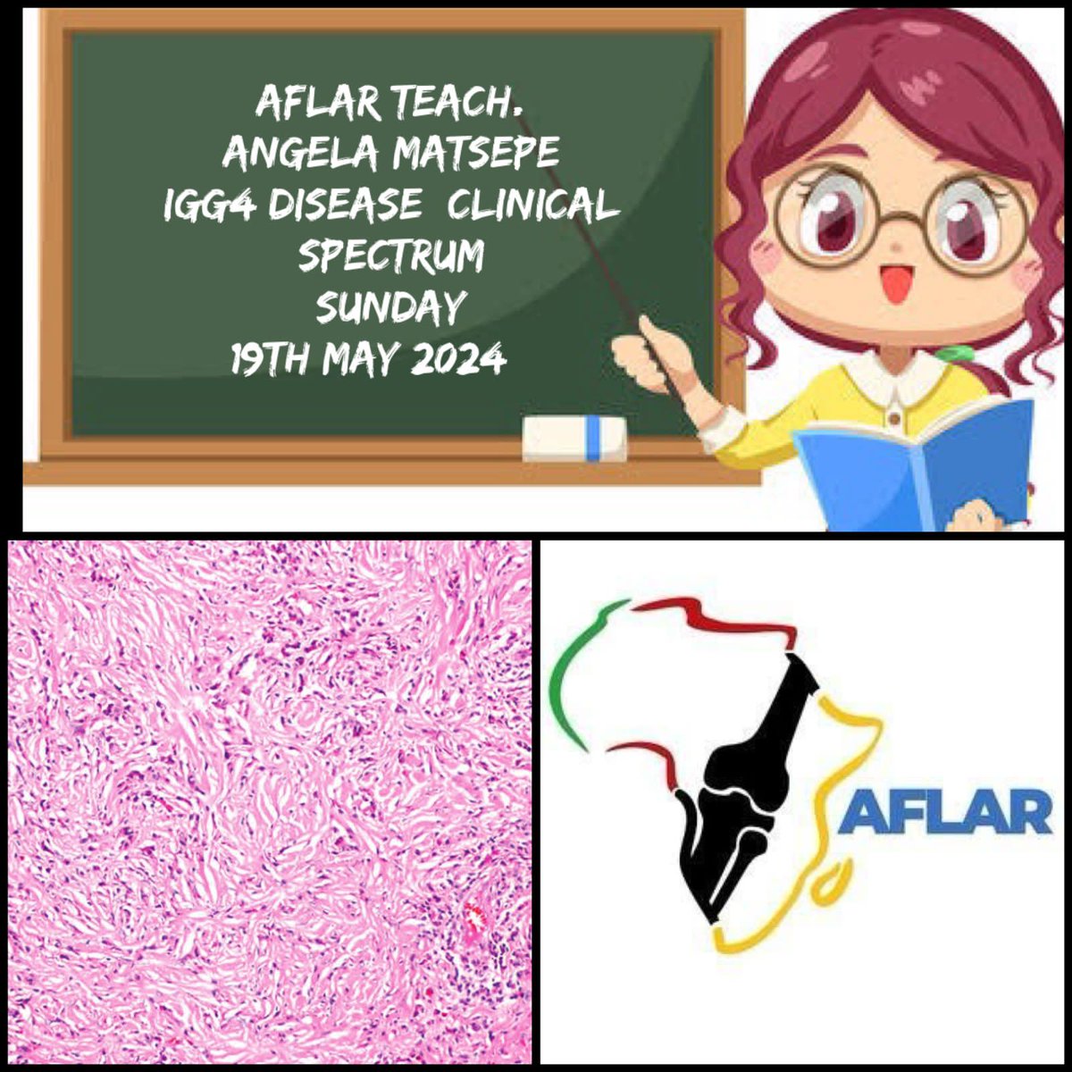 Please save date for AFLAR TEACH case study.
This Sunday at 16:00pm CAT