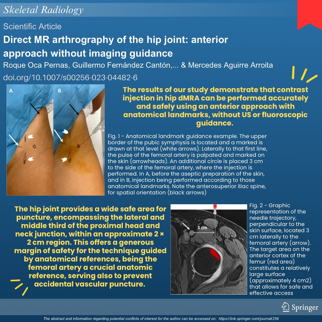 Learn about direct hip arthrography. Read the infographic: 

🔴 Direct MR arthrography of the hip joint: anterior approach without imaging guidance

To read the full article, access the link: rdcu.be/dE821 

#SkeletalRadiology #orthotwitter #orthopedics #radres #MSKrad