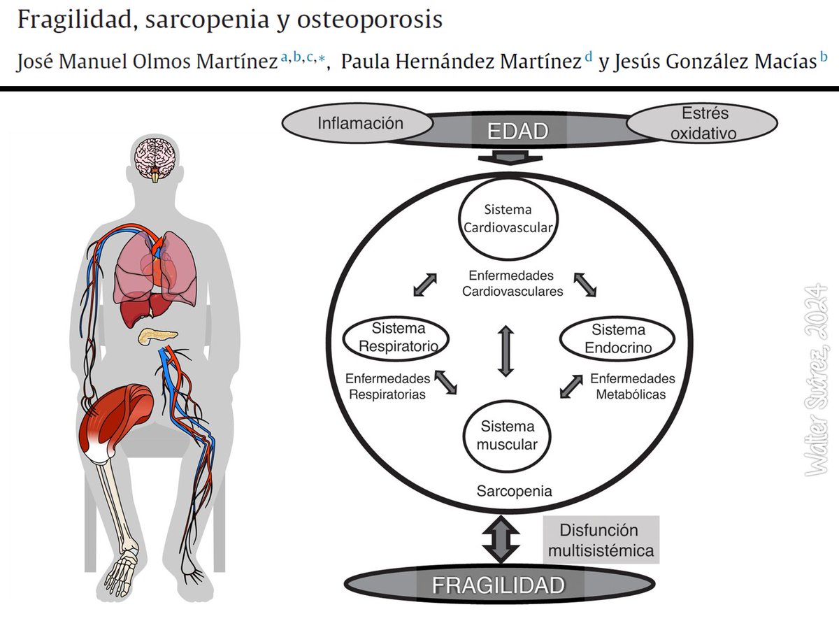 FRAGILIDAD, SARCOPENIA Y OSTEOPOROSIS

Artículo muy sencillo y aclaratorio. Ideal como resumen de conceptos. 

drive.google.com/file/d/1npBVTw…