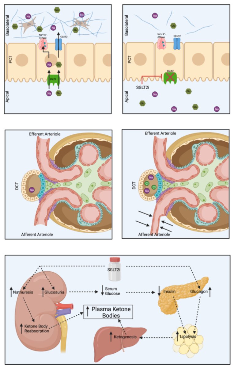 #mdpijcm 💝Enjoy today's Highly Cited Paper: Therapeutic Advances in Diabetic Nephropathy 👥@HannySawaf et al. @NakhoulGN @tvachh @AliMehdiMD 🏥@ClevelandClinic 👍 Citations 50, Views 13543 🔗mdpi.com/1447620 @MedPharma_MDPI #diabetes #kidney #Nephropathy